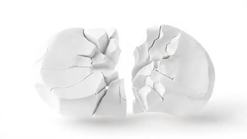 Modelos 3D muestran fracturas con claridad